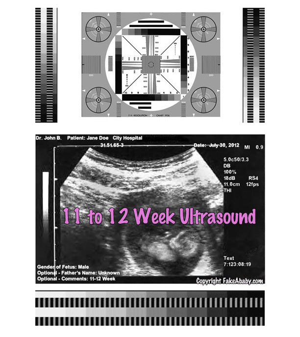 Fake Ultrasounds