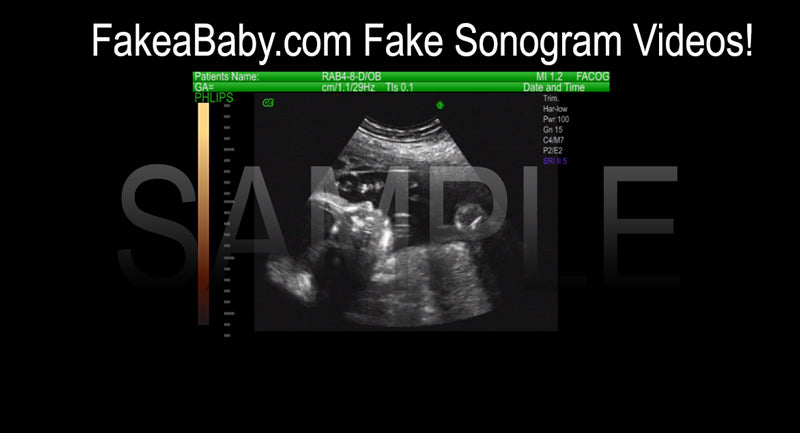 gefälschte Sonogram