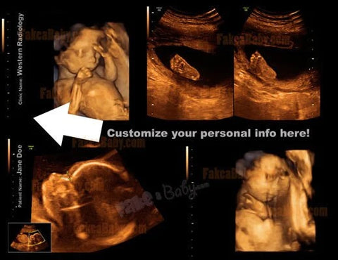 Fake Baby Ultrasound Custom
