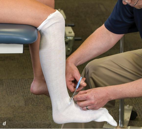 Methods for immobilizing the fractured foot and ankle – Human Kinetics