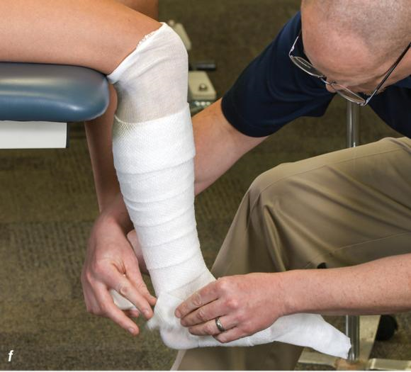 Methods for immobilizing the fractured foot and ankle – Human Kinetics  Canada