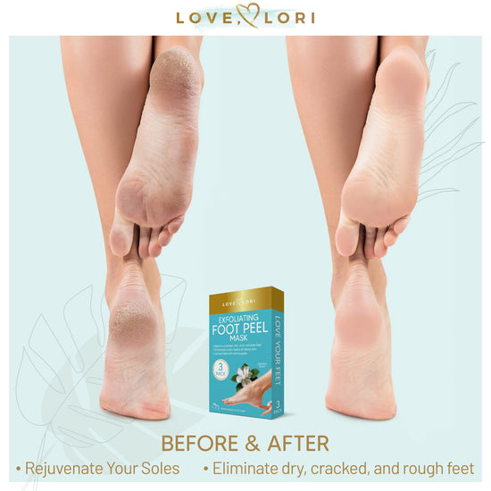  Lavinso Foot Peel Mask for Dry Cracked Feet – 4 Pack Dead Skin  Remover Foot Mask for Cracked Feet and Callus - Exfoliating Feet Peeling  Mask for Soft Baby Feet, Original