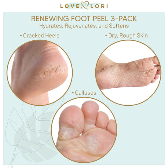 Love, Lori Callus Remover Gel & Moisturizing Foot Mask Set (3-Pack) for  Smooth Soft Feet At Home