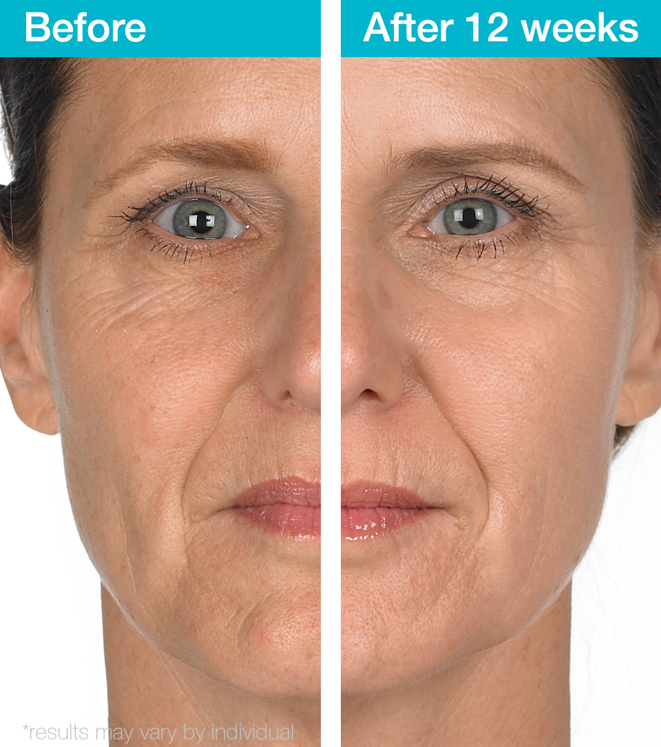 This Is How Your Skin Changes as You Age (20s, 30s, 40s, 50s, and Beyond)