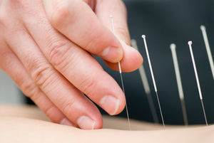 Chinese Medicine - Acupressure & Acupuncture