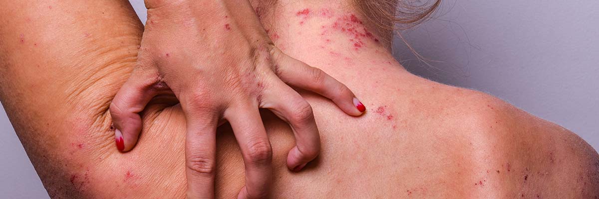 AMPERNA® Biologics for Skin Issues