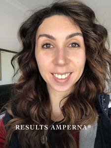 Acne Skin Care | RESULTS AMPERNA