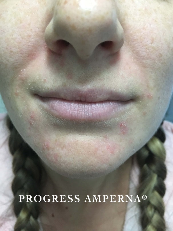 Testimonials | AMPERNA® Active Skincare