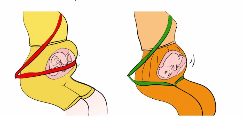 Ceinture de sécurité pour la grossesse et les femmes enceintes – 👶 Parents  Sereins