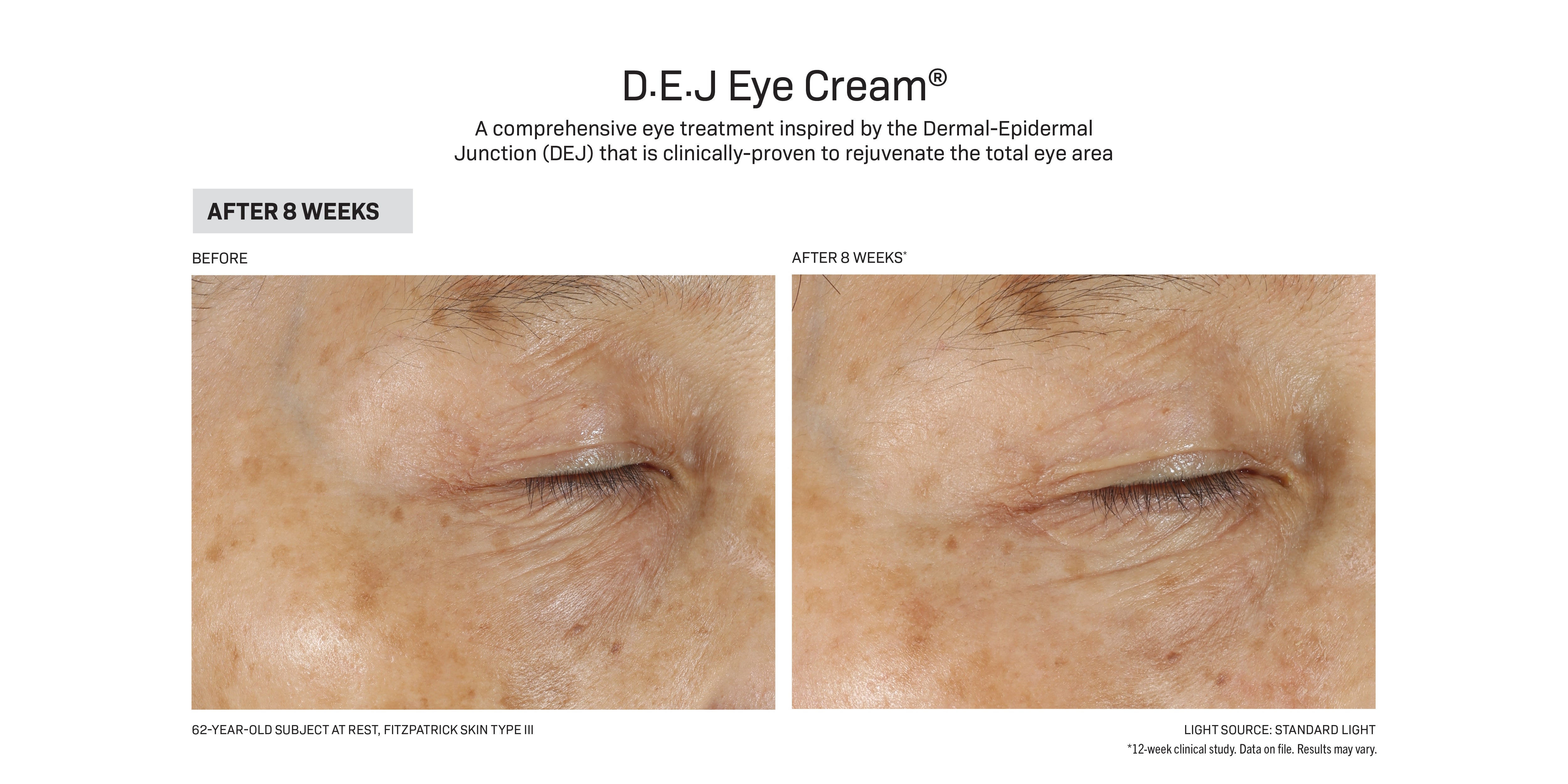 Revision Skincare D·E·J Eye Cream® 0.5 fl oz – Revive Clinical