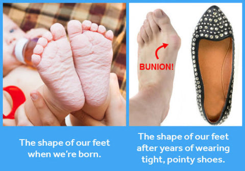 Image courtesy of softstarshoes.com - how the shape of our feet changes after years of wearing shoes.