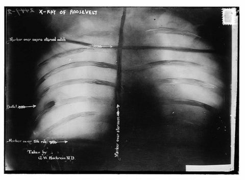 TRThursday: Roosevelt is Shot in the Chest During a Speech - Wolf and Iron