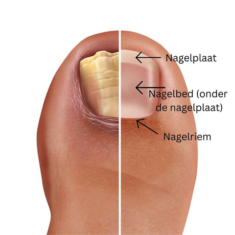 Schimmelnagel versus gewone nagel | INDISHA