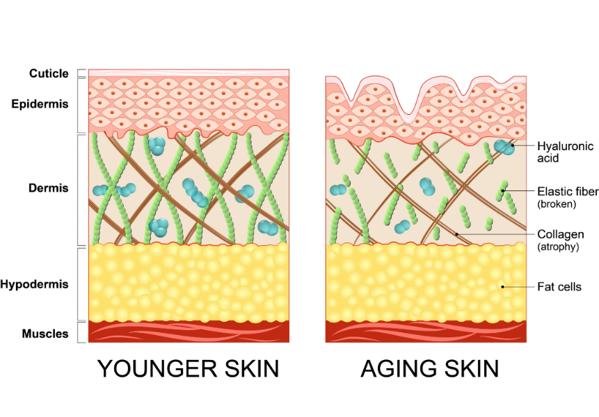 aging skin