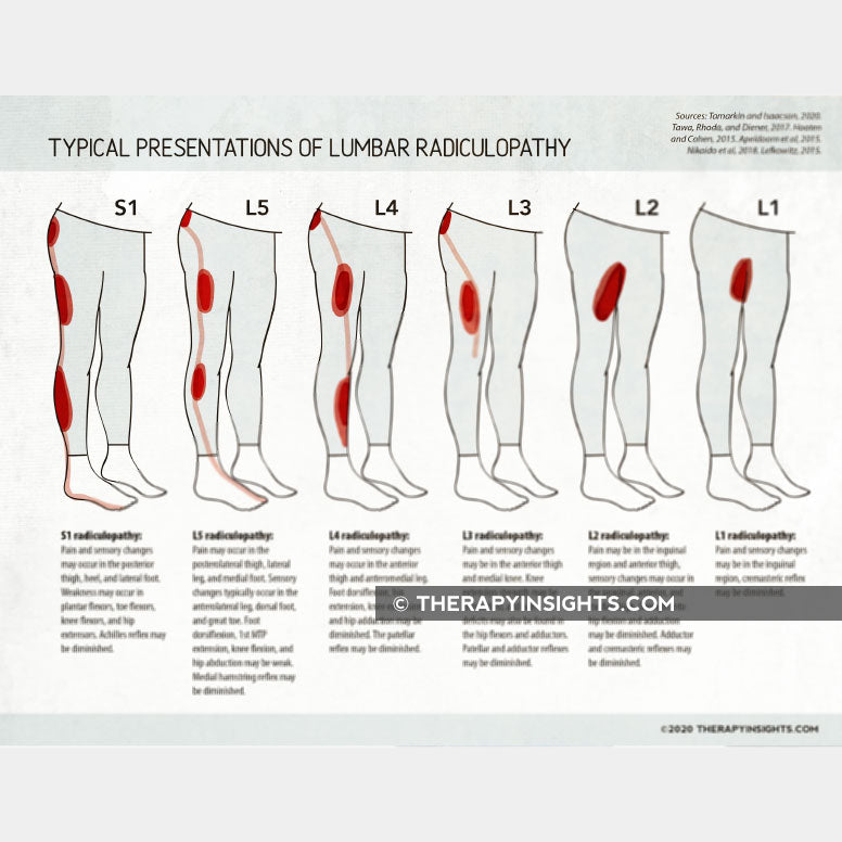 Lumbar Radiculopathy Myotomes