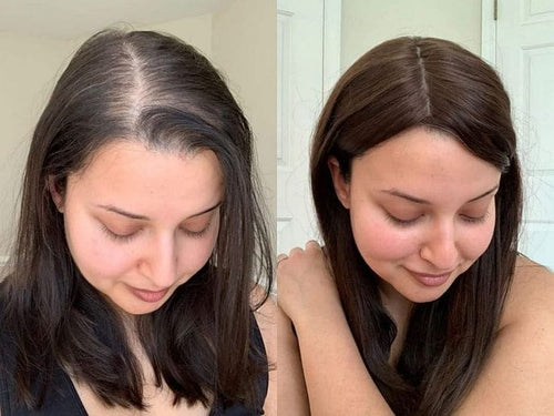 Before And After Hair growth Barbara