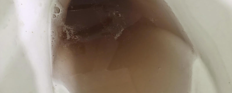 Dark urine within toilet bowl