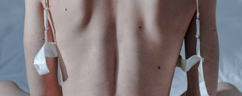 Female back with moles