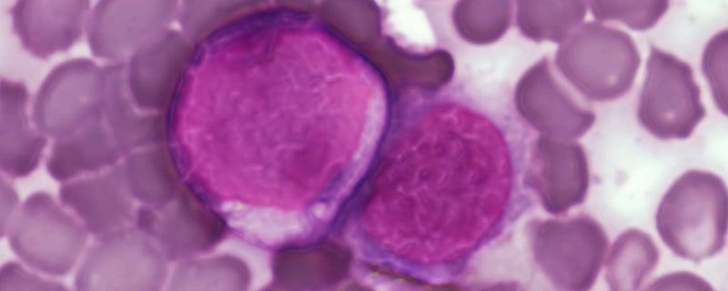 Leukemia cells