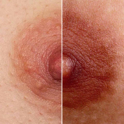 Nipple comparison