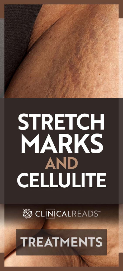 Cellulite and Stretch Mark Treatments