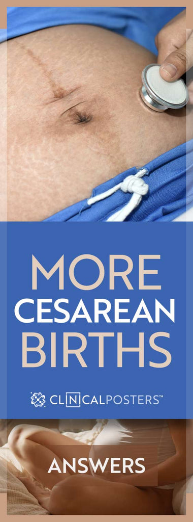 More cesarean births