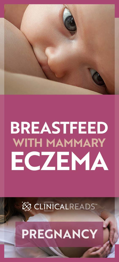 Should Mothers With Nipple Eczema Breastfeed?