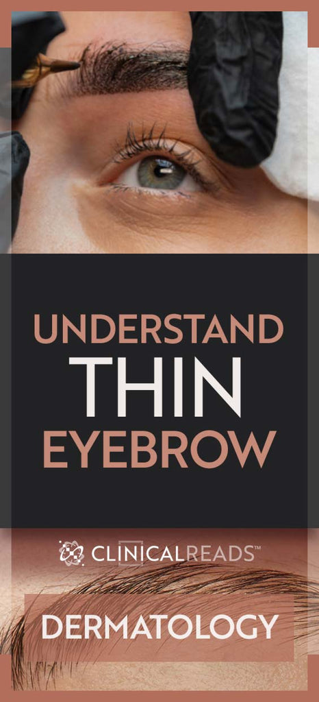 Understand Thin Eyebrow