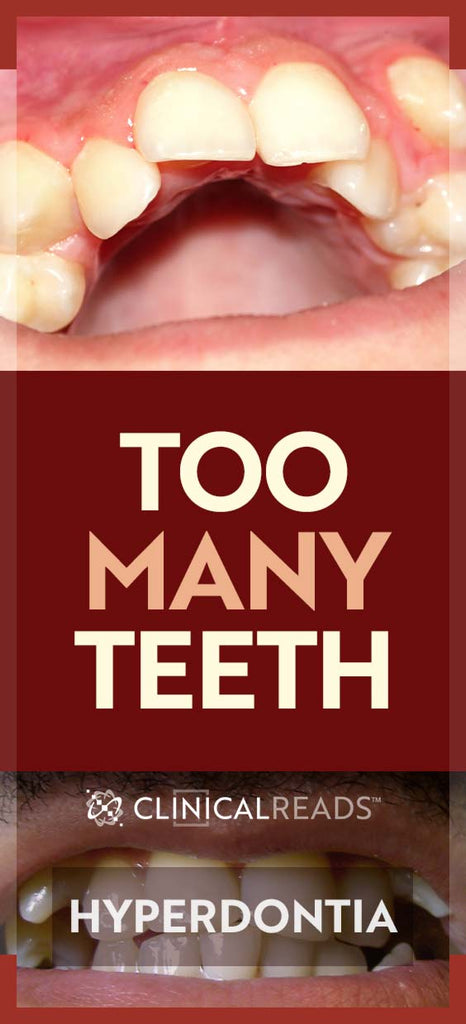 Too Many Teeth