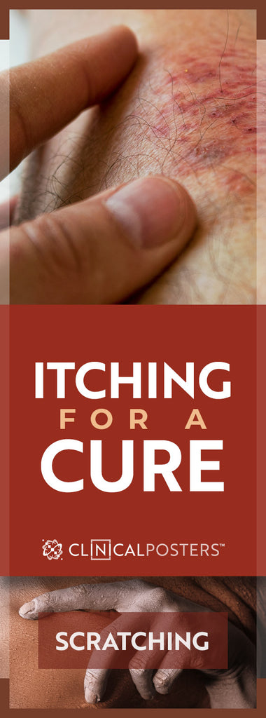 Itching for a Cure