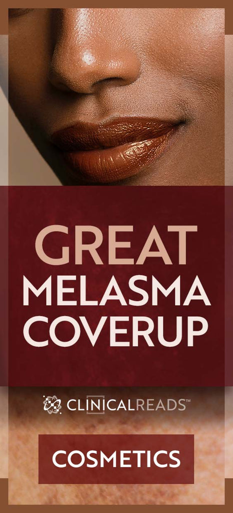 Great Melasma Coverup