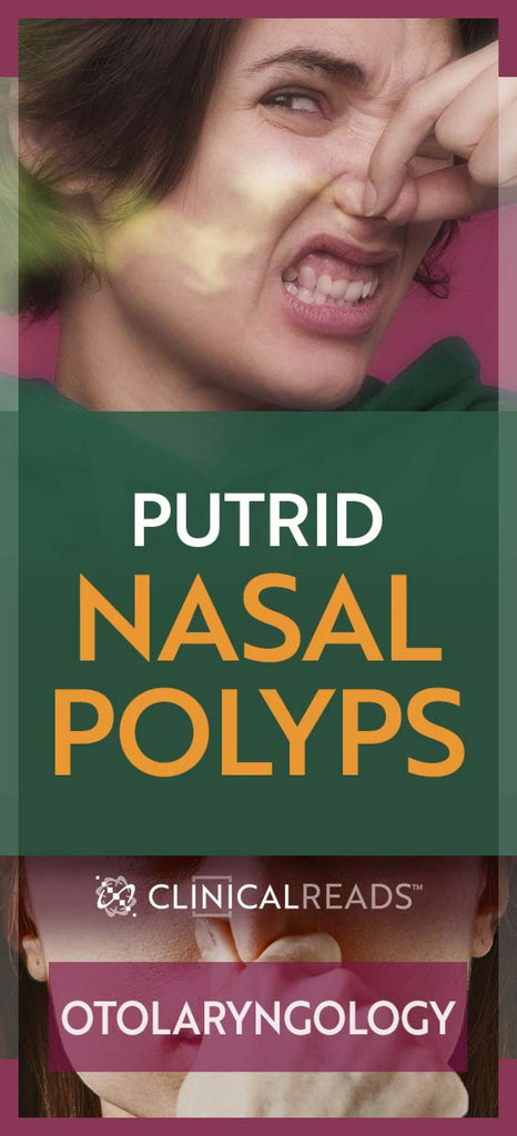 Putrid Nasal Polyps