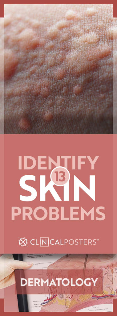 13 Skin Eruptions Signaling Underlying Disorders #dermatology