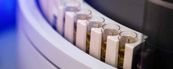 Urine Laboratory Testing