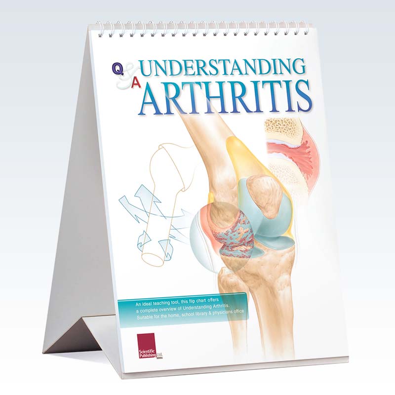 Understanding Arthritis Flip Chart 11x14 Clinicalposters