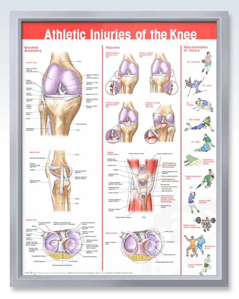 Athletic Knee Injuries Anatomy Poster ClinicalPosters