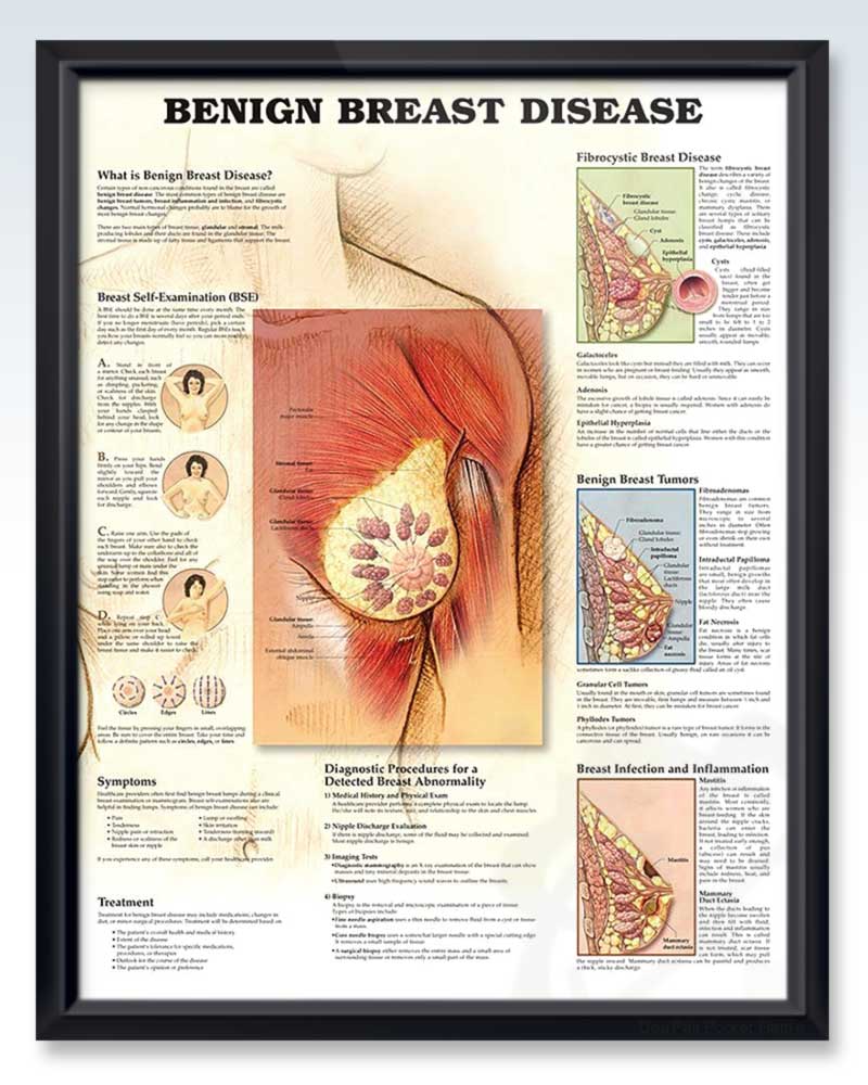 3B Scientific VR1556L Glossy Laminated Paper Female Breast Anatomy,  Pathology and Self-Examination Chart, Poster Size 20 Width x 26 Height