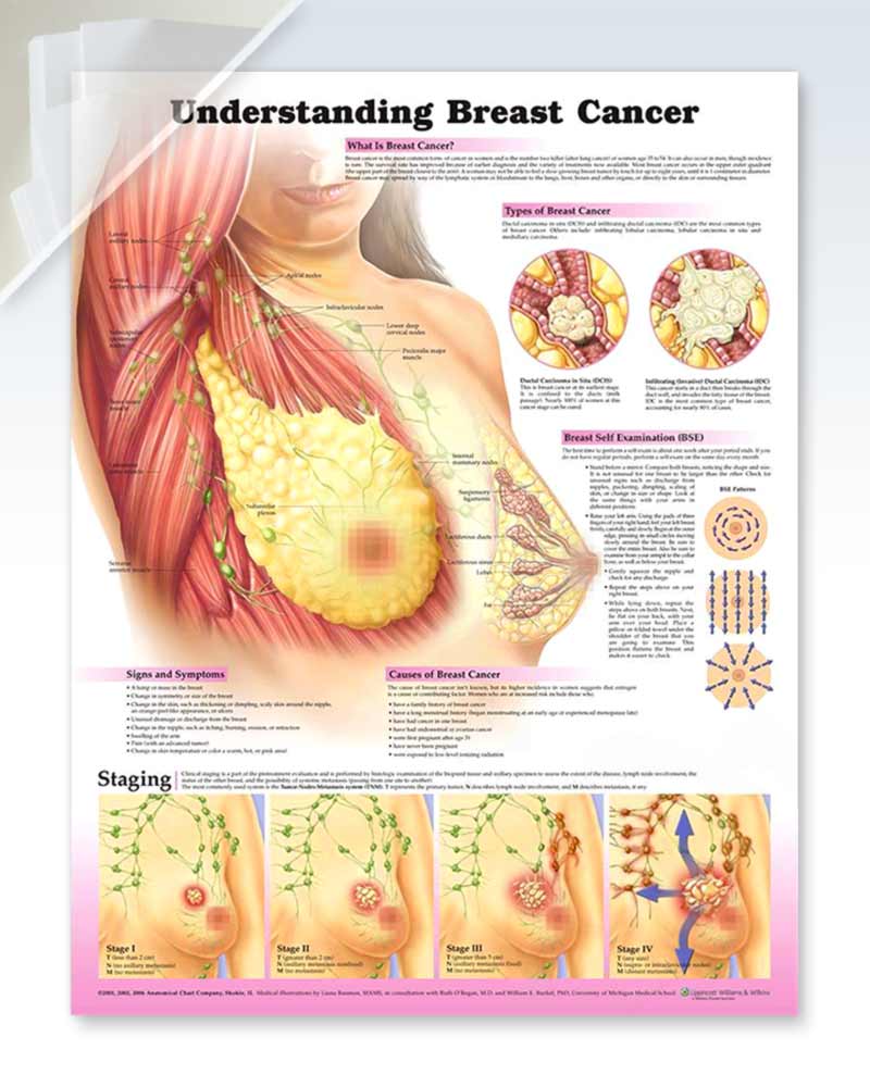 3B Scientific VR1556L Glossy Laminated Paper Female Breast Anatomy,  Pathology and Self-Examination Chart, Poster Size 20 Width x 26 Height