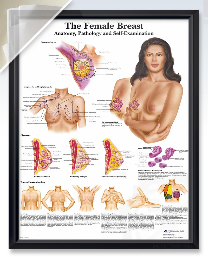 Female Breast Exam-Room Anatomy Posters