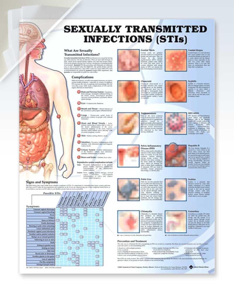 Sexually Transmitted Infections Exam Room Posters Clinicalposters 9380