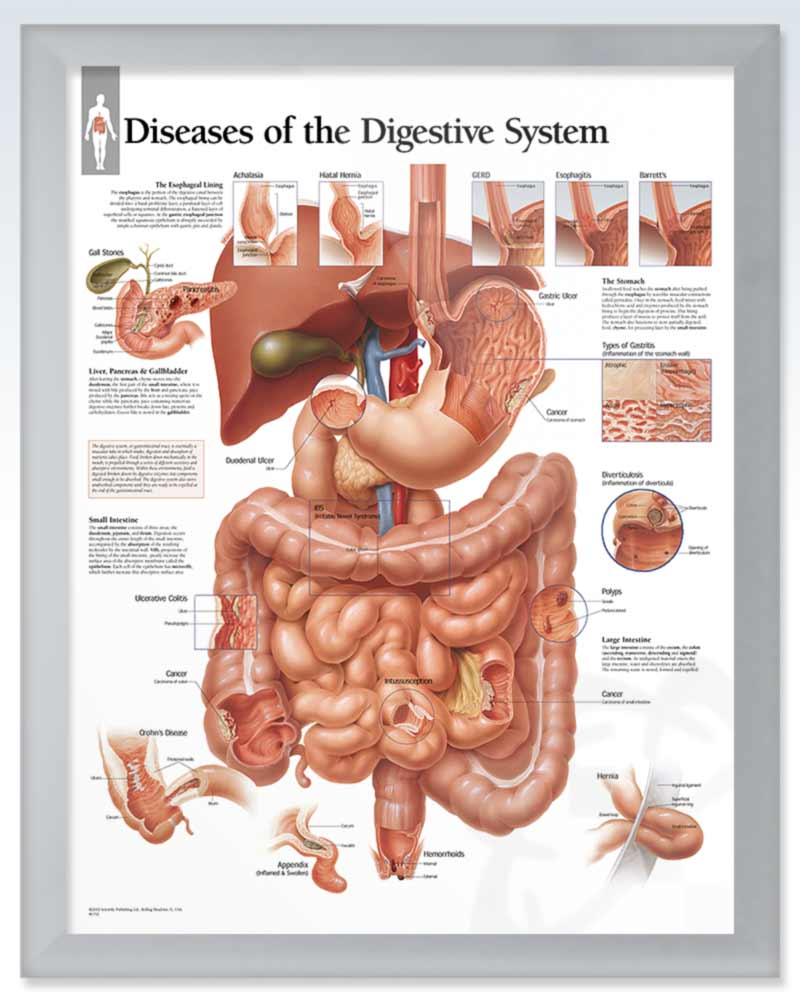 Diseases of the Digestive System ExamRoom Anatomy Poster ClinicalPosters