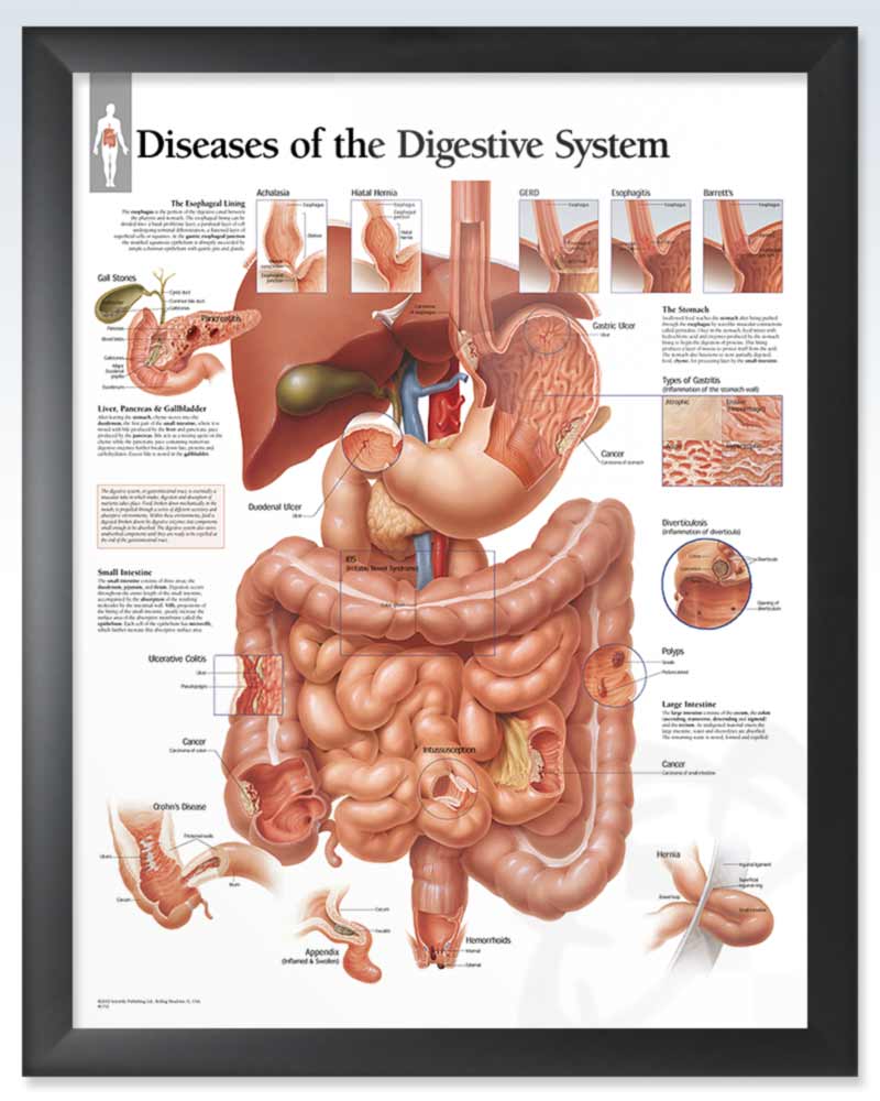 Diseases of the Digestive System ExamRoom Anatomy Poster ClinicalPosters