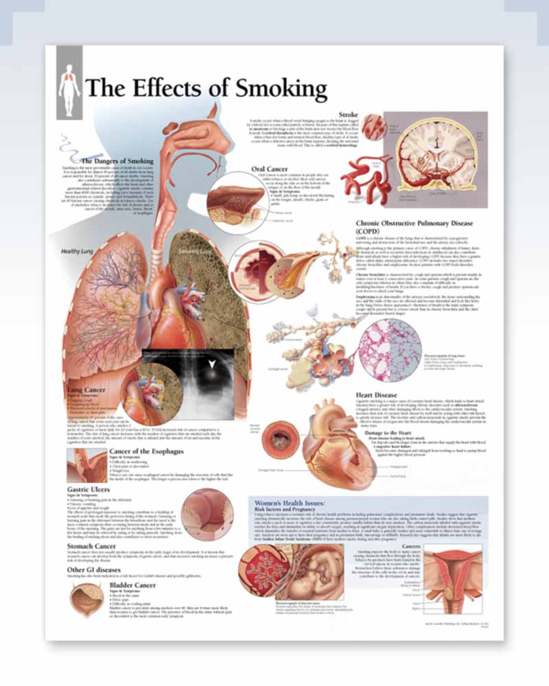 Effects Of Smoking Exam Room Anatomy Poster Clinicalposters
