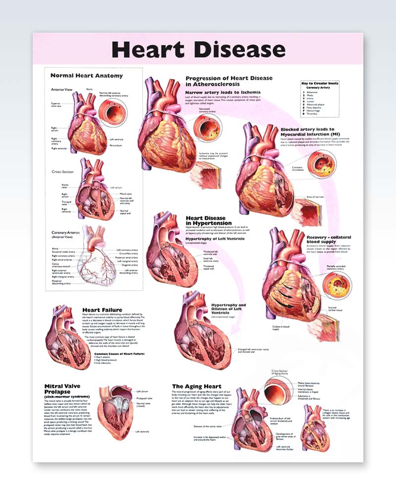 Heart Disease Exam Room Anatomy Poster – ClinicalPosters 12 lead diagram anatomy 