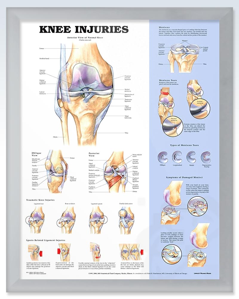 Knee Injuries Exam Room Human Anatomy Poster ClinicalPosters