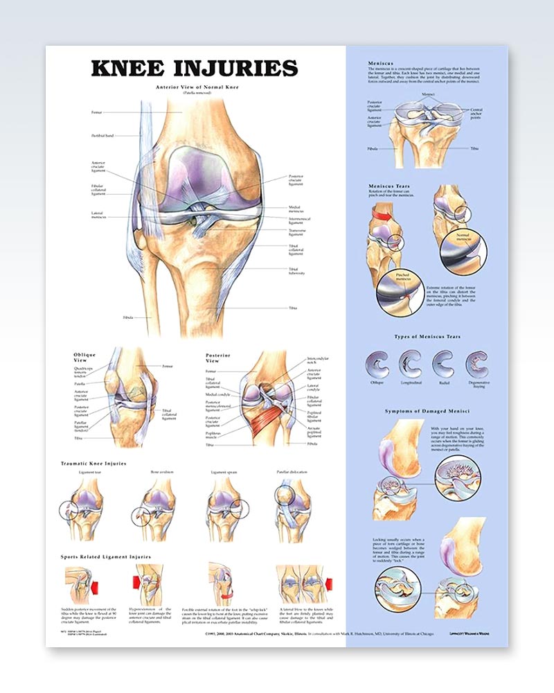 Knee Injuries Exam Room Human Anatomy Poster Clinicalposters