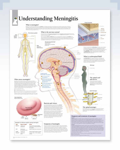 Understanding Meningitis anatomy poster