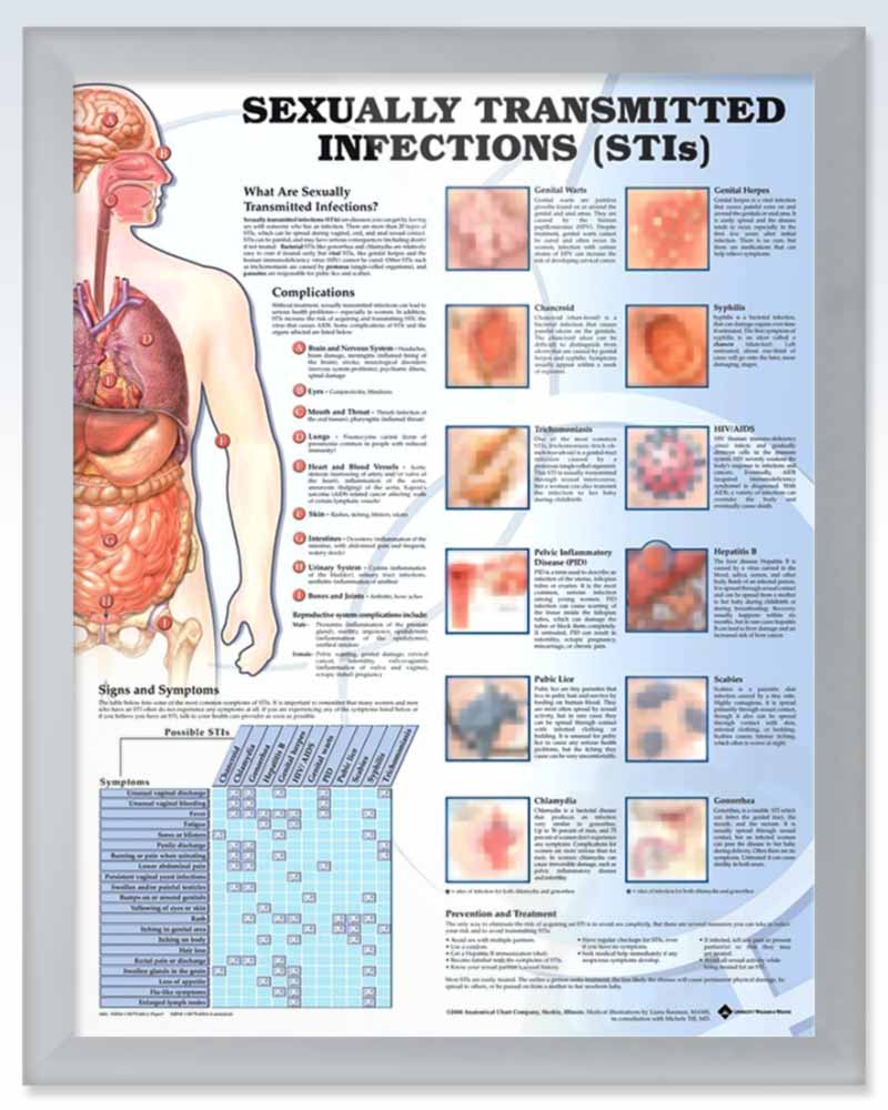 Sexually Transmitted Infections Anatomy Posters Clinicalposters 4117