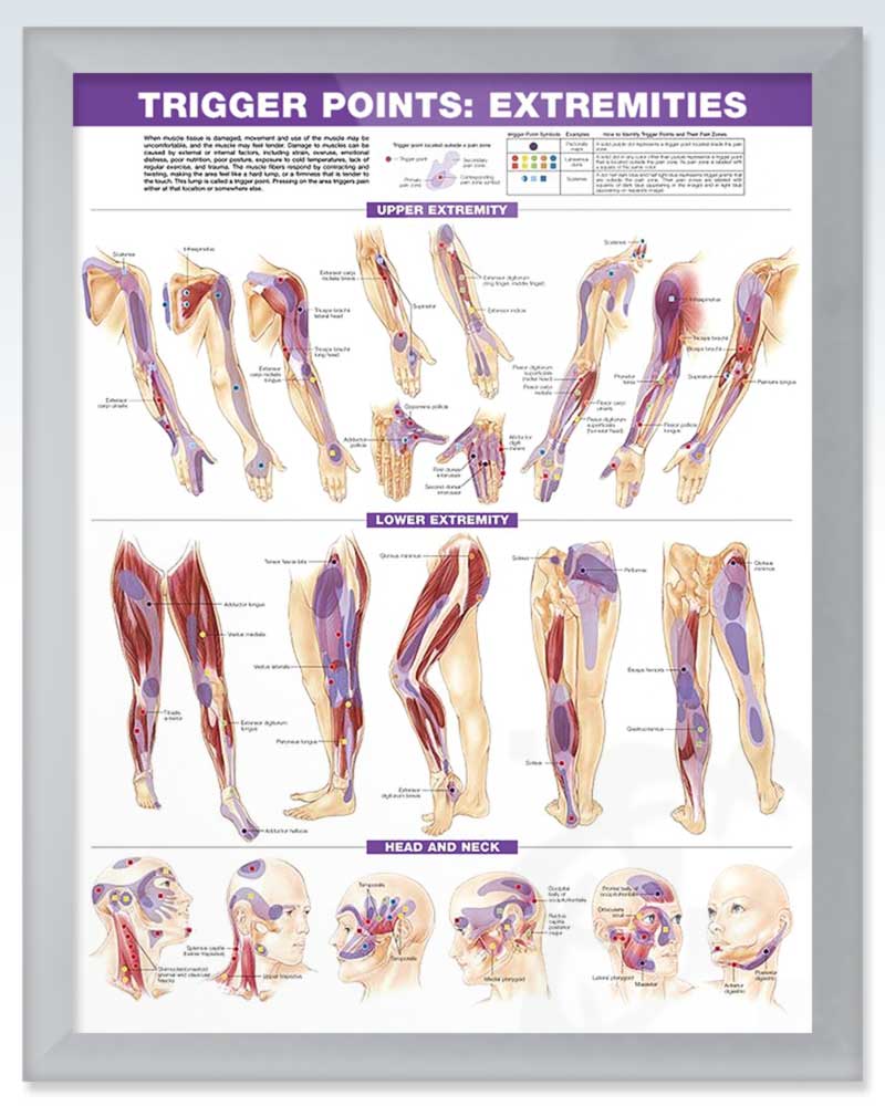 Trigger Points Set ExamRoom Anatomy Posters ClinicalPosters