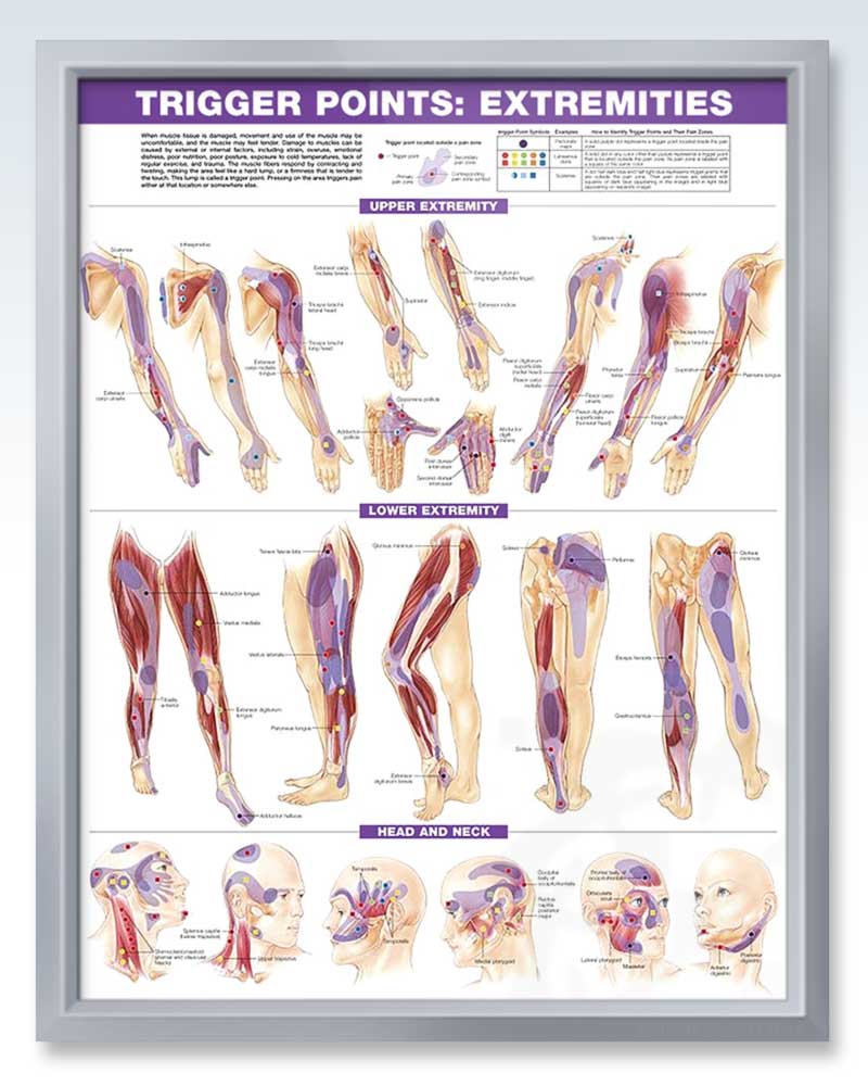 trigger-points-set-exam-room-anatomy-posters-clinicalposters